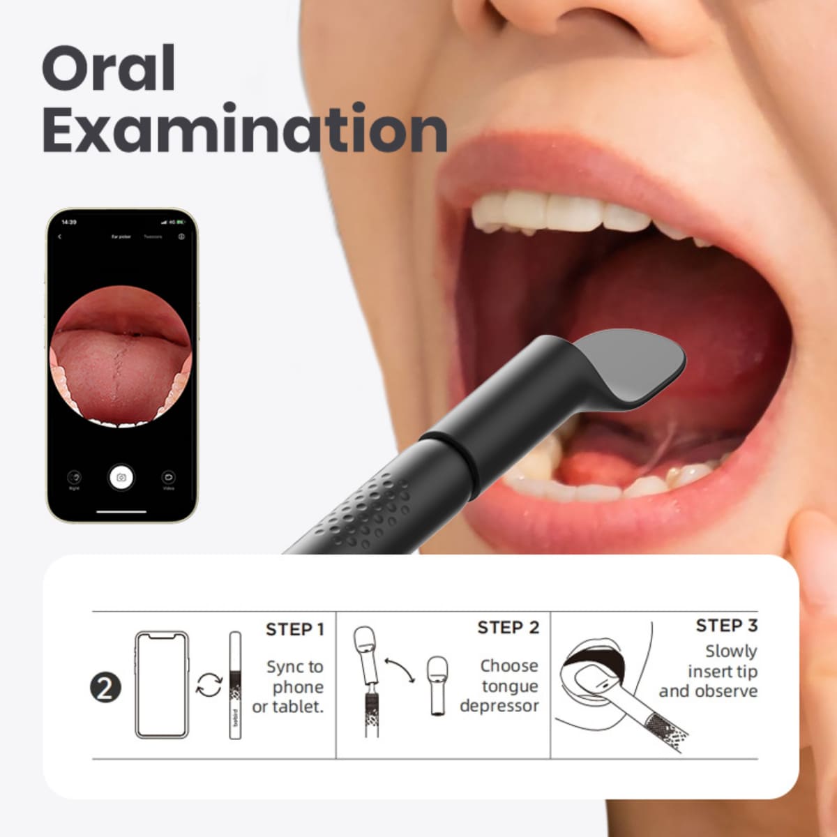 monitoring of the oral cavity camera